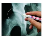 Marqueur edding e-8010 spécial radiologie