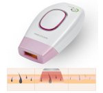 Système épilateur PC-IPL 3024, nacre/rose