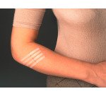 Strisce 3M™ Nexcare™ Steri-Strip™ per suture cutanee, 8 unità assortite