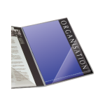 Hoektas Djois  170x170mm zelfklevend PP transparant 100 stuks