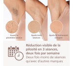 Epilation semi-définitive Philips Lumea série 8000 SenseIQ BRI945