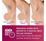 Epilation semi-définitive Philips Lumea série 7000 BRI920/00