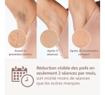 Epilation semi-définitive Philips Lumea série 9000 BRI958/00 Epilateur à lumière pulsée sans-fil