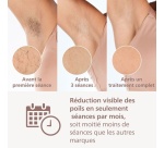Epilation semi-définitive Philips Lumea Series 9900 BRI951/01 Epilateur à lumière pulsée