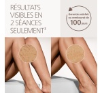 Epilation semi-définitive Philips Epilateur à lumière pulsée Lumea Series 8000 BRI932/00  Blanc Rose