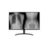 LG 32HL512D-B Computerbildschirm 80 cm (31.5 Zoll) 3840 x 2160 Pixel Full HD Schwarz