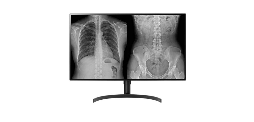 LG 32HL512D-M écran plat de PC 80 cm (31.5") 3840 x 2160 pixels Full HD Noir