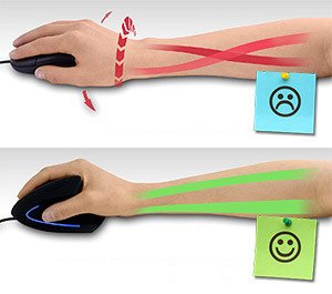 Pourquoi choisir une souris ergonomique verticale ?